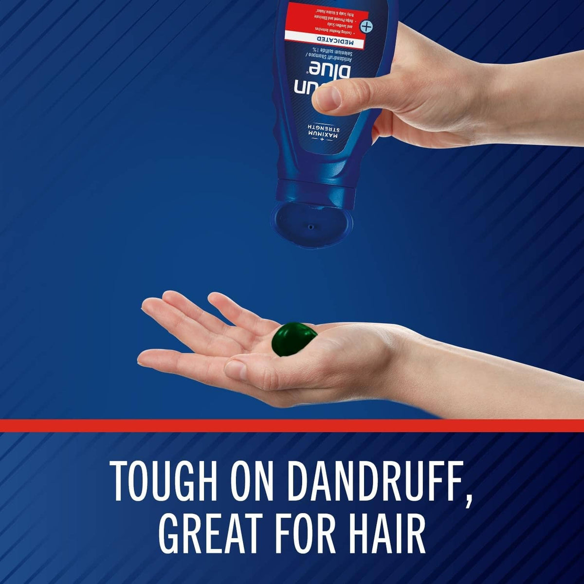 Medicated anti-dandruff shampoo bottle dispensing into open hands, blue cap