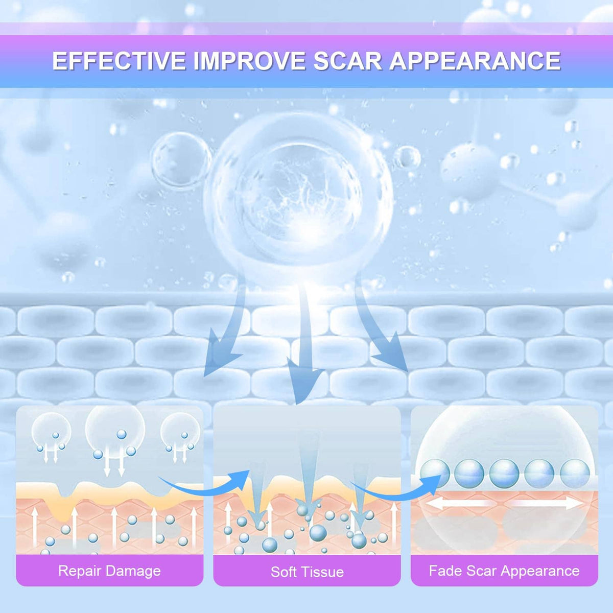 Scar appearance improvement diagram for silicone scar gel treatment