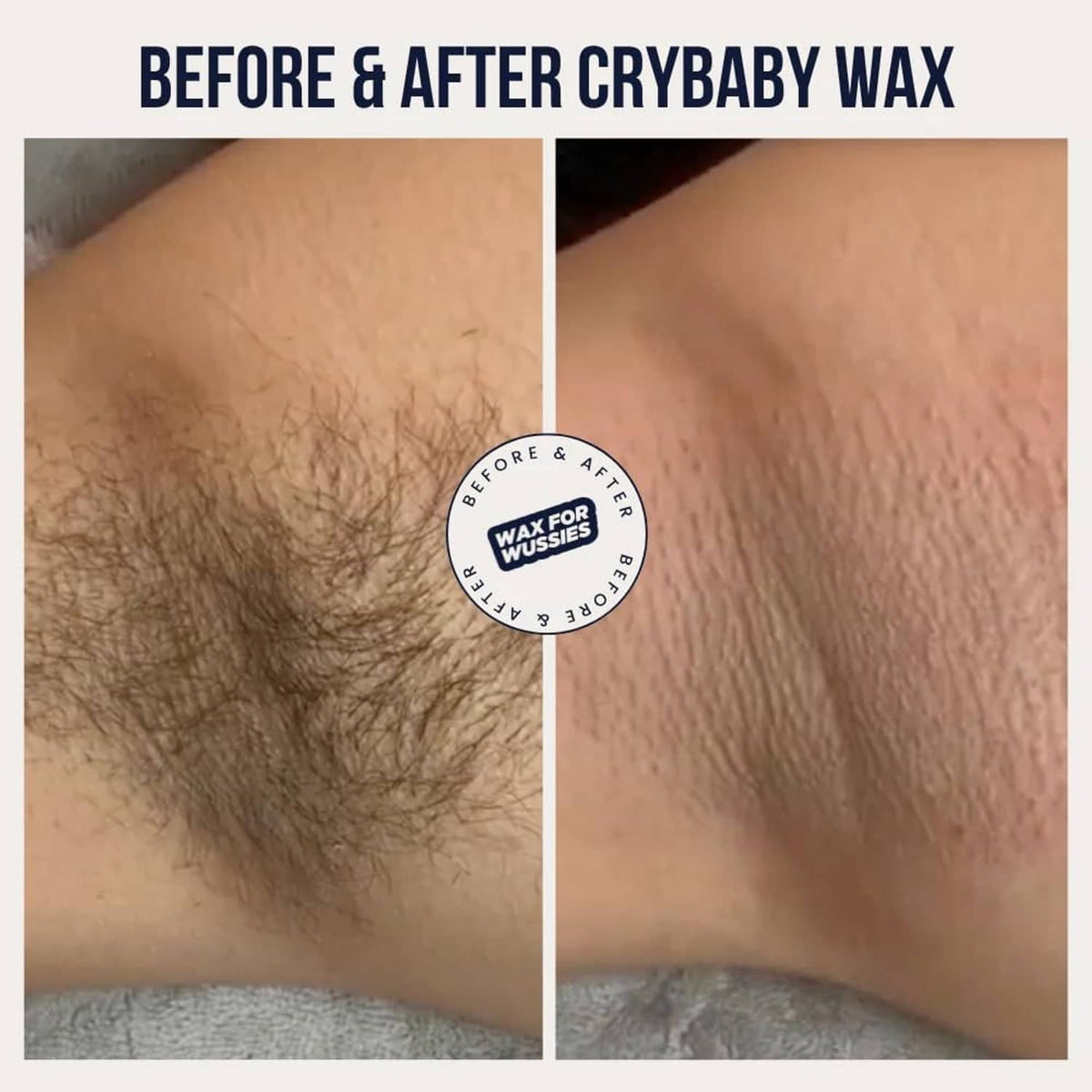 Before-and-after skin photos for exfoliating splash after waxing